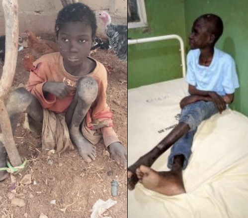 Epileptic boy rescued