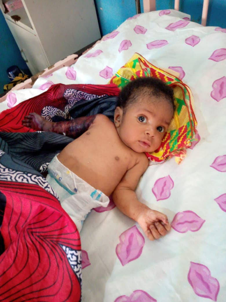 Father allegedly beats his 2-month-old son with hanger in Imo for disturbing his sleep, breaks the baby