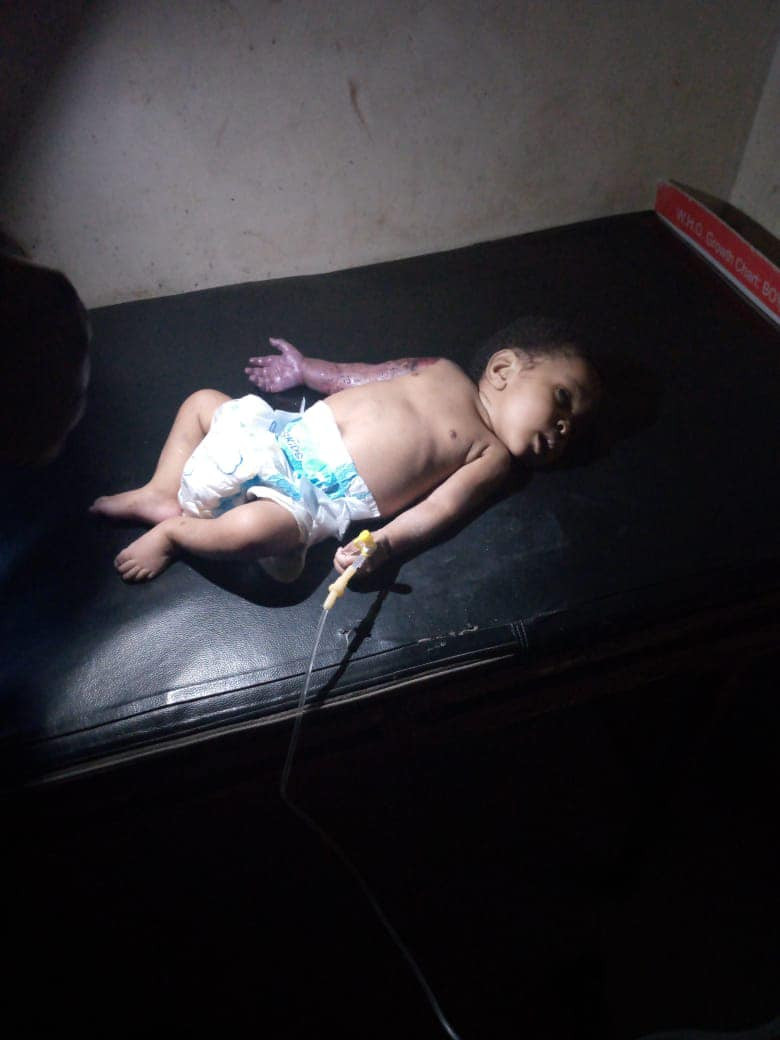 Father allegedly beats his 2-month-old son with hanger in Imo for disturbing his sleep, breaks the baby